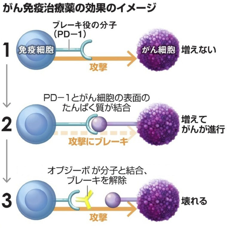 がん治療薬で期待の持てる新薬剤はオプジーボ