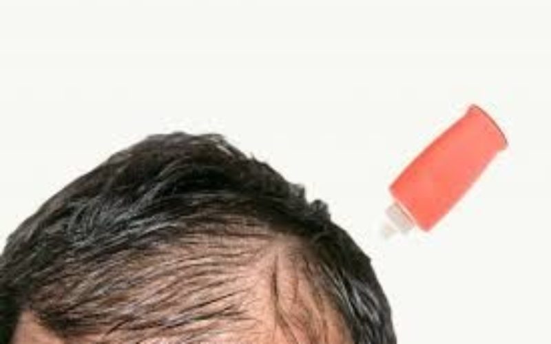 薄毛と肥満はバランスの取れた食事でホルモンの改善