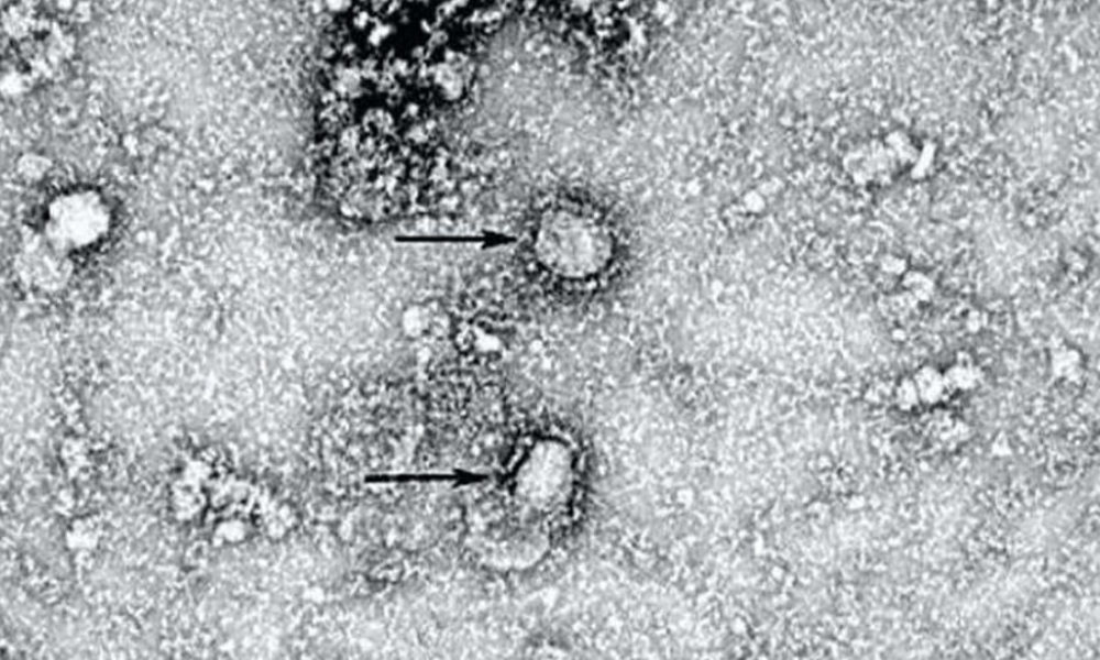 新型のコロナウイルスの感染者が東京で3人発見され14人に拡大