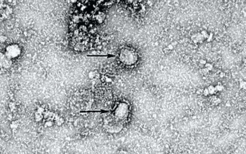 新型のコロナウイルスの感染者が東京で3人発見され14人に拡大