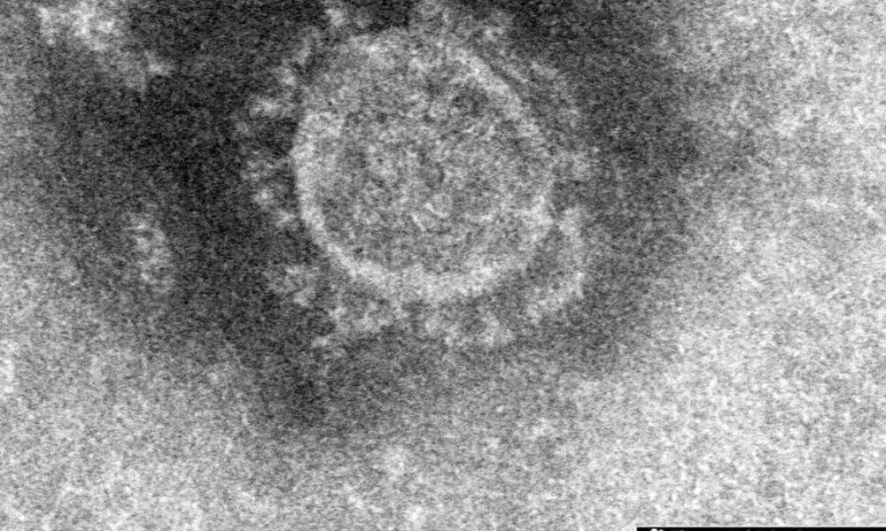 新型コロナウイルスに感染した男性が受け入れ先を模索中に自宅で死亡