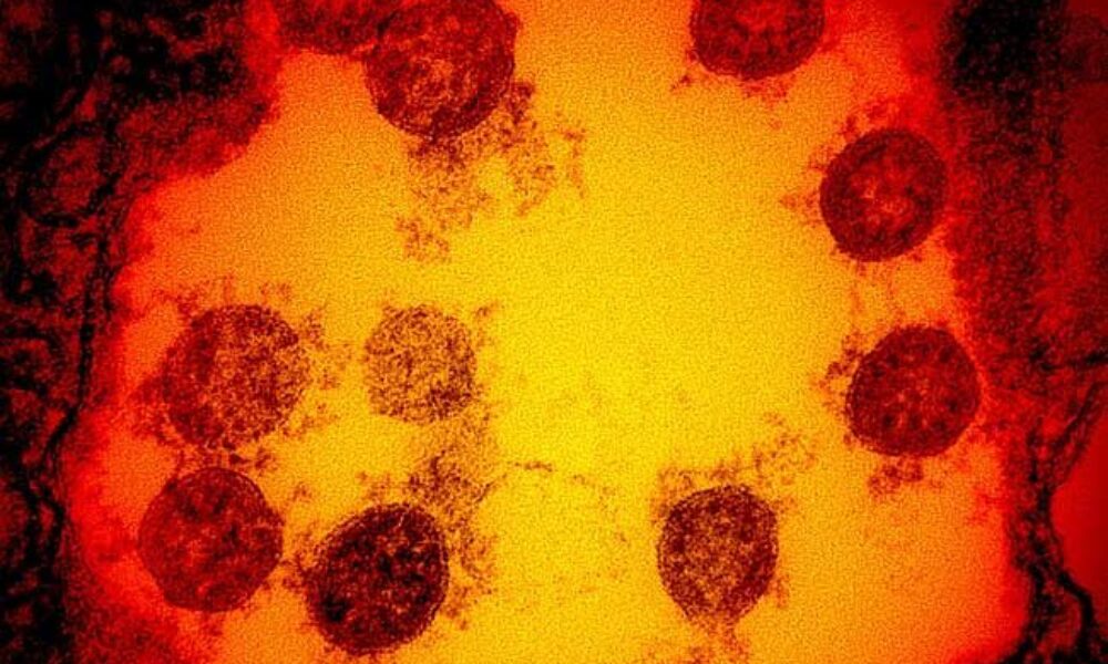 南アフリカや隣接する国で見付かっている変異したコロナウイルスの驚異