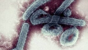 西アフリカのガーナで致死率の高いマールブルグ・ウイルスに罹り2人が死亡