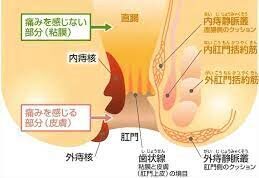 肛門に発症するがん細胞は痔の痛みやかゆみに便秘の影響からなり得る可能性